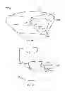 Fig. 35 - Systems and apparatuses for inserting an implant in intervertebral space