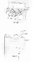 Fig. 43 - Systems and apparatuses for inserting an implant in intervertebral space