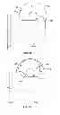 Fig. 44 - Systems and apparatuses for inserting an implant in intervertebral space