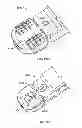 Fig. 64 - Systems and apparatuses for inserting an implant in intervertebral space
