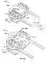 Fig. 75 - Systems and apparatuses for inserting an implant in intervertebral space