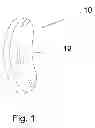 Fig. 02 - SHOULDER INTER-SPACER COMPONENT AND SURGICAL METHOD OF IMPLANTATION