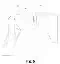 Fig. 07 - SHOULDER INTER-SPACER COMPONENT AND SURGICAL METHOD OF IMPLANTATION