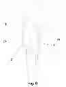 Fig. 08 - SHOULDER INTER-SPACER COMPONENT AND SURGICAL METHOD OF IMPLANTATION