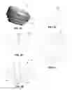Fig. 09 - Modular reverse shoulder prostheses