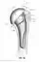 Fig. 13 - Modular reverse shoulder prostheses