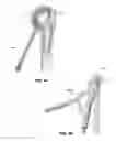 Fig. 15 - Modular reverse shoulder prostheses