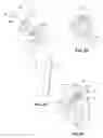 Fig. 24 - Modular reverse shoulder prostheses