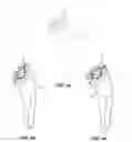 Fig. 27 - Modular reverse shoulder prostheses
