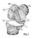 Fig. 02 - Surgical guide for implanting a knee prosthesis
