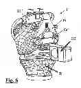 Fig. 07 - Surgical guide for implanting a knee prosthesis