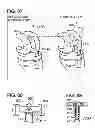 Fig. 09 - IMPLANT WITH MULTI-DIRECTIONAL PIVOTING