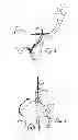 Fig. 02 - Sacroiliac joint immobilization