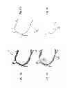 Fig. 09 - Method and system for patient-specific modeling of blood flow