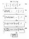 Fig. 03 - Pseudo-random bit sequence generator
