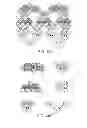 Fig. 12 - Method for exploiting massive parallelism