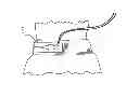 Fig. 01 - BELT DEVICE FOR SECURING THE EXTERNAL PORTION OF A CATHETER