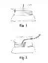 Fig. 02 - BELT DEVICE FOR SECURING THE EXTERNAL PORTION OF A CATHETER
