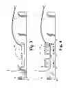 Fig. 03 - BELT DEVICE FOR SECURING THE EXTERNAL PORTION OF A CATHETER