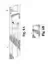 Fig. 05 - BELT DEVICE FOR SECURING THE EXTERNAL PORTION OF A CATHETER