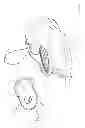 Fig. 34 - Surface cleaning apparatus