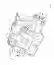Fig. 09 - Surface cleaning apparatus