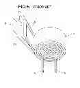 Fig. 06 - Method of manufacturing an electrolytic capacitor