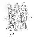 Fig. 01 - Stent with radiopaque markers
