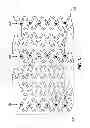 Fig. 06 - Stent with radiopaque markers