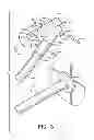 Fig. 04 - METHOD OF INSTALLING A SHOWER ROD MOUNTING BRACKET