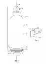 Fig. 02 - Beverage Container with Hand-Line