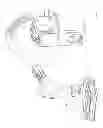 Fig. 09 - Cyclone such as for use in a surface cleaning apparatus