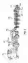 Fig. 02 - Front end loader hay rake