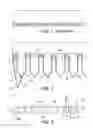 Fig. 02 - Cutting header with finger mounted raised divider pans