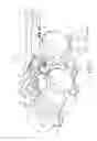 Fig. 02 - Mounting assembly for reductant injector with thermal isolation and sealing gasket