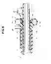 Fig. 06 - Ultrasound probe system