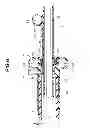 Fig. 07 - Ultrasound probe system