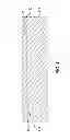 Fig. 05 - CATHETER DIE AND METHOD OF FABRICATING THE SAME