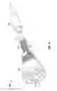 Fig. 02 - System, method, and device for sensing pressure of a fluid