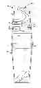 Fig. 01 - Fecal microbiome transplant material preparation method and apparatus