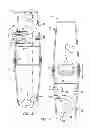 Fig. 03 - Fecal microbiome transplant material preparation method and apparatus