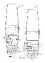 Fig. 04 - Fecal microbiome transplant material preparation method and apparatus