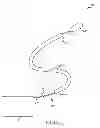 Fig. 02 - Transmitting torque with a handle to an operative element through a working channel