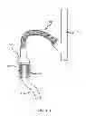 Fig. 45 - Transmitting torque with a handle to an operative element through a working channel