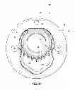 Fig. 07 - Multiple-way bottle cap opener and method