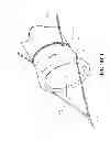 Fig. 02 - Guide for a sail sleeve, sail collapsing arrangement and methods therefor