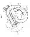 Fig. 02 - Air intake system for internal combustion engine