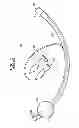 Fig. 02 - Expandable Inter Vivos Tube