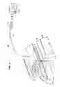 Fig. 08 - Expandable Inter Vivos Tube