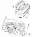 Fig. 02 - Mouth Guard